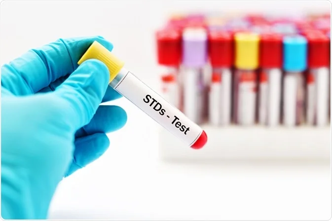 Top 5 Benefits Of Regular STD Testing