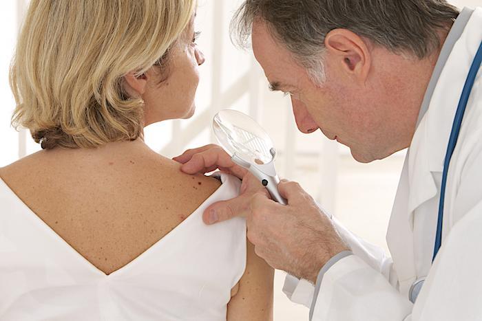 Why Regular Dermatologist Checkups are Important