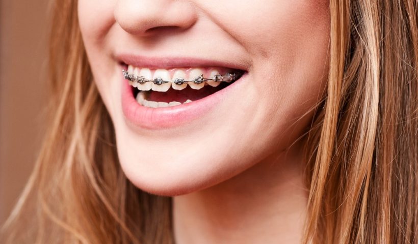 orthodontics florida