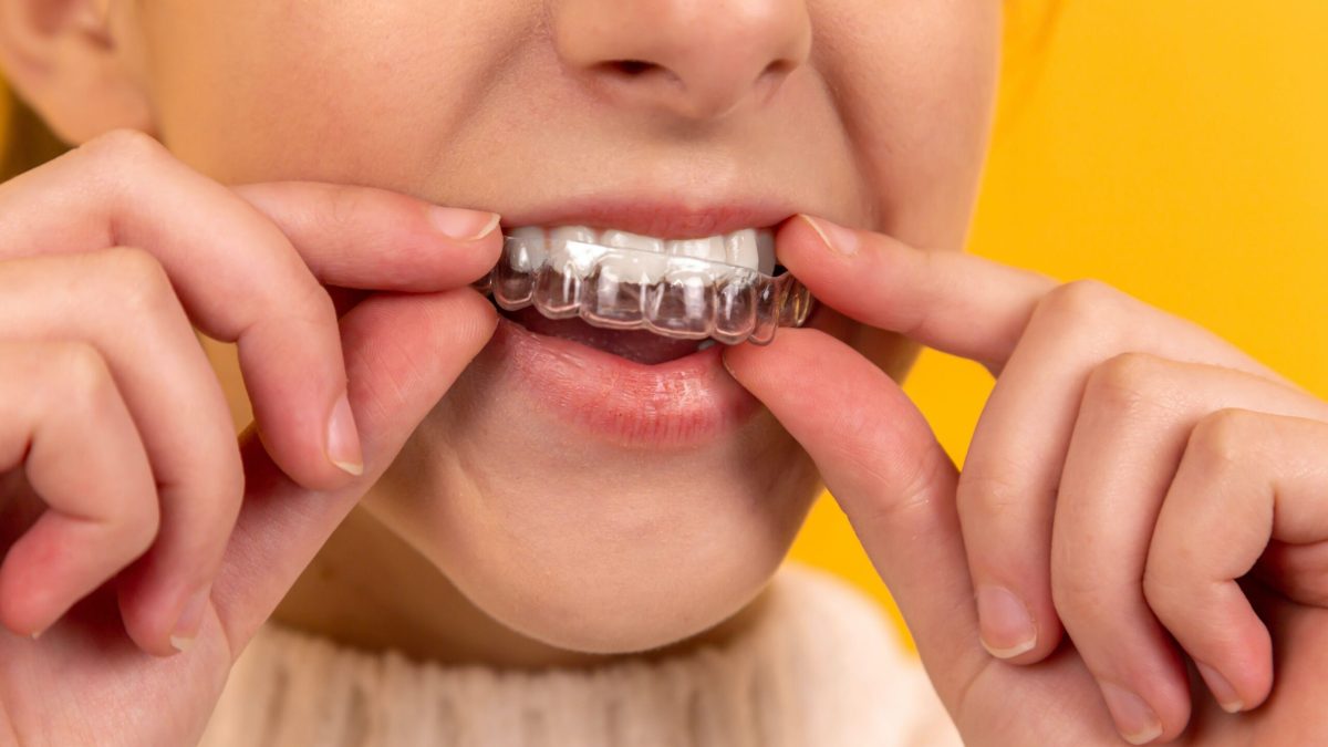 Key Splint Hard Resin vs Soft Resin: Which is Better?