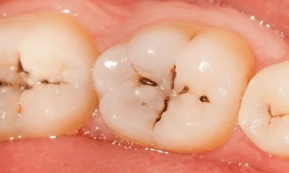 How Family Dentists Help Patients Navigate Changes In Dental Coverage